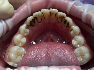 ������� ����� ���� �� �����: ����� �� ����������?